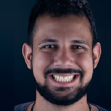 Antes — Clareamento dental